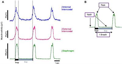 Comparison of the effects of fentanyls and other μ opioid receptor agonists on the electrical activity of respiratory muscles in the rat